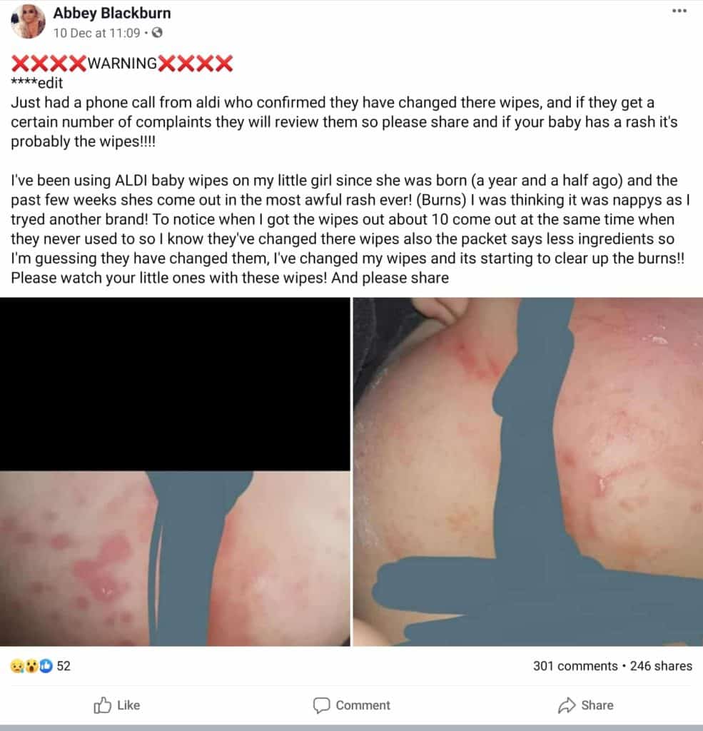 Mothers claim Aldi baby wipes have caused severe rashes and blisters 2