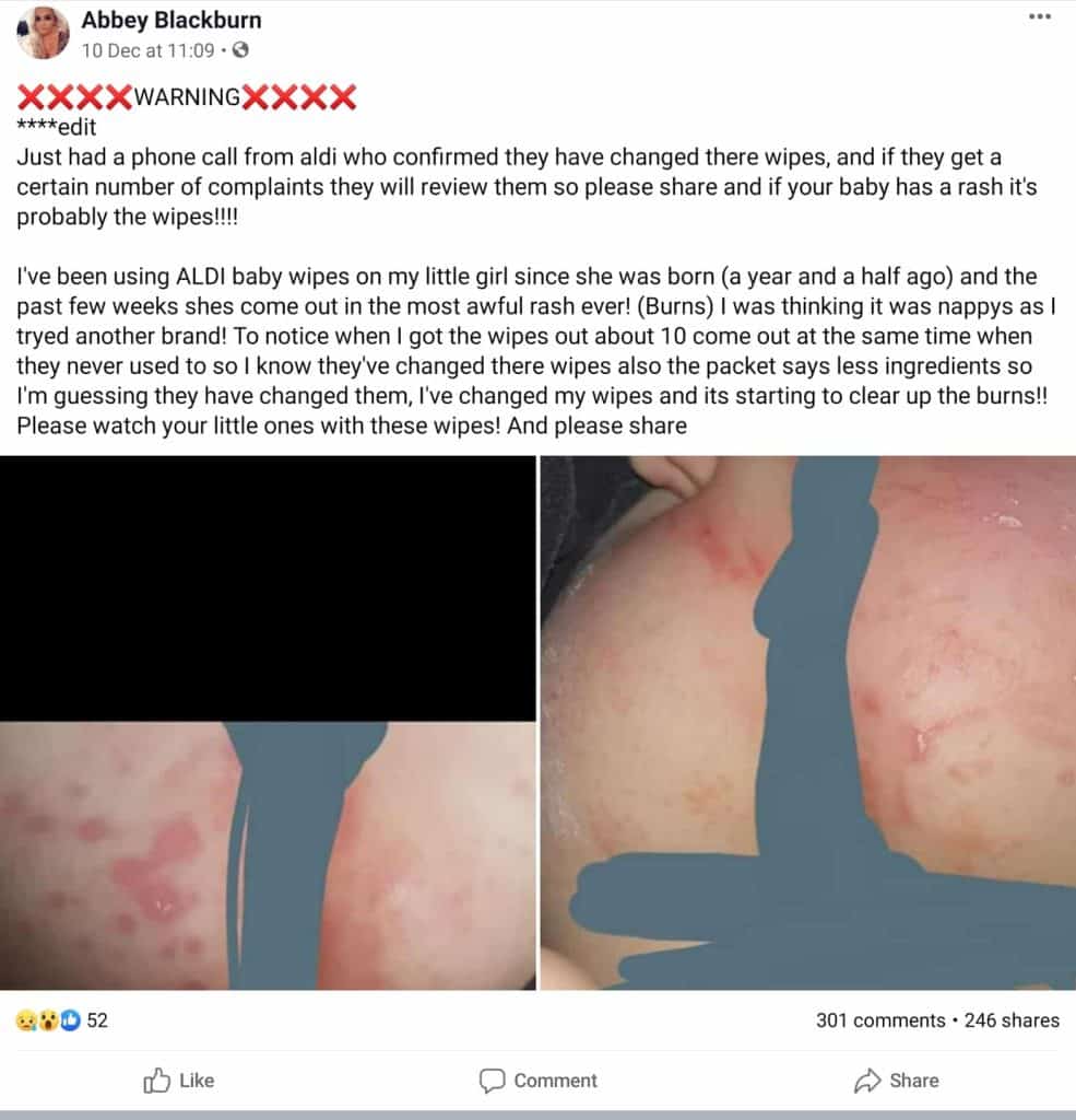 Mothers claim Aldi baby wipes have caused severe rashes and blisters 2 Mothers claim Aldi baby wipes have caused severe rashes and blisters 2